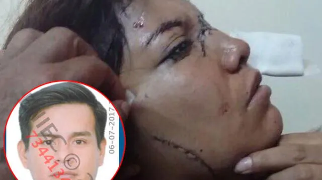 Poder Judicial ordenó la captura contra Anthony Oré Reyes por agredir a Luz Giannina Vásquez Ambicho