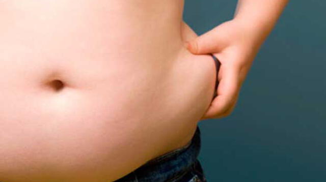 Mal nutrición y la genética son las causas de la obesidad