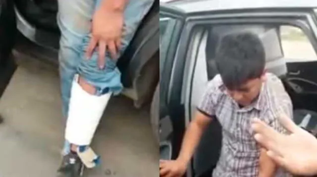 Delincuente se rompe una pierna durante persecución policial