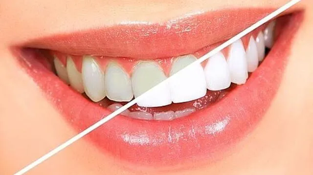 Unos dientes blancos es una señal de buena salud