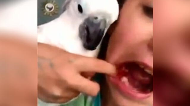 Cacatúa dentista ayuda a su dueña a sacarle el diente 