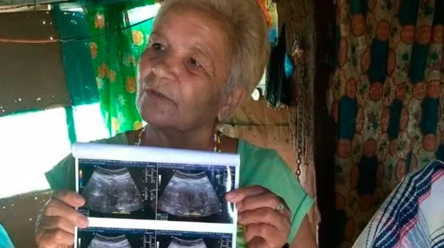 Mexicana de 70 años podría ser la mujer más longeva en dar a luz