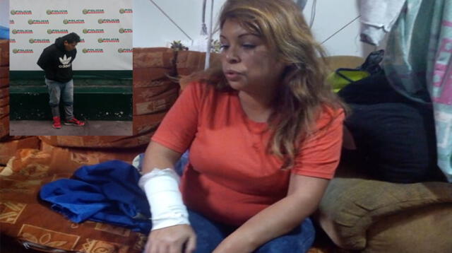 Una mujer fue atacada en el Cercado de Lima por su ex pareja 