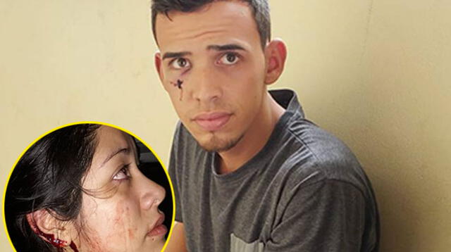 Los Olivos: venezolano corta la oreja a mujer al intentar robarle [FOTO]