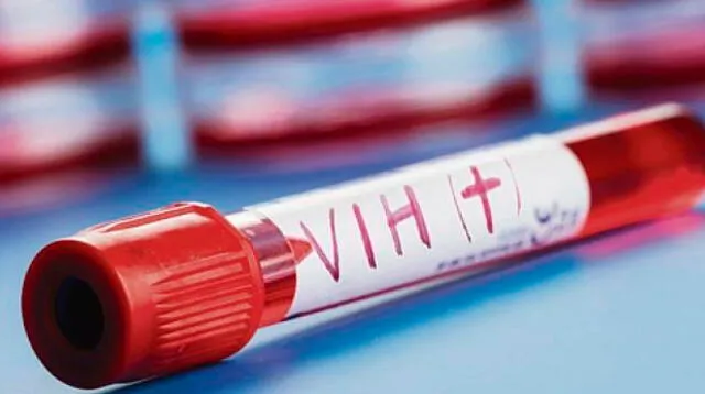 VIH ha sido tratado por científicos en España