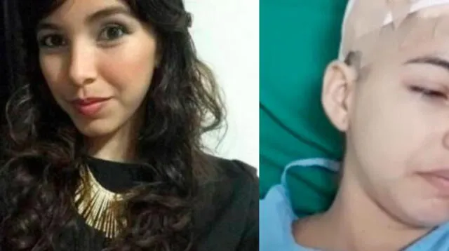 Colombiana Kenede Susana Vega Garizao estuvo cerca de perder todo el cabelludo
