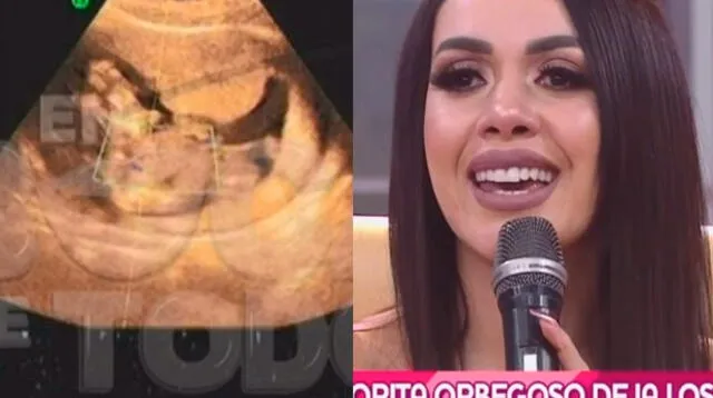 Dorita Orbegoso confirma que será madre 