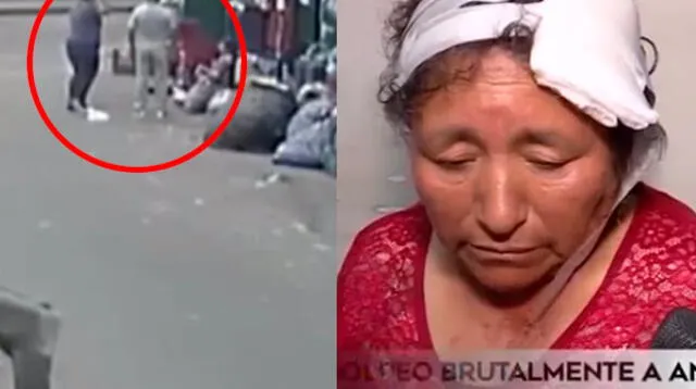 Mujer fue salvajemente agredida con un palo