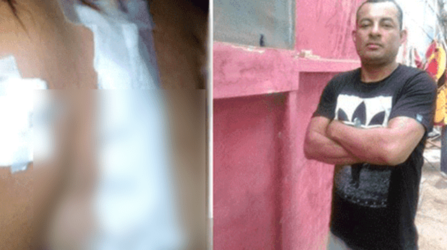 Intenta cortar la yugular de su pareja con un cúter en Piura Intenta cortar la yugular de su pareja con un cúter en Piura