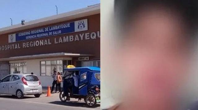 Una mujer dio insecticida a su bebé en hospital de Lambayeque