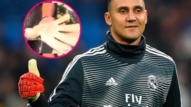 Keylor Navas le regaló sus guantes a hincha peruano