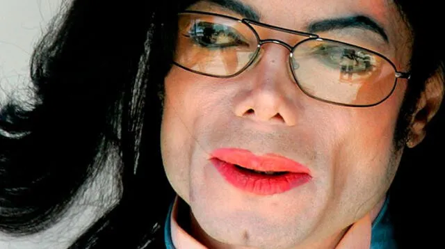 Michael Jackson estaba totalmente calvo y con cicatrices cuando murió