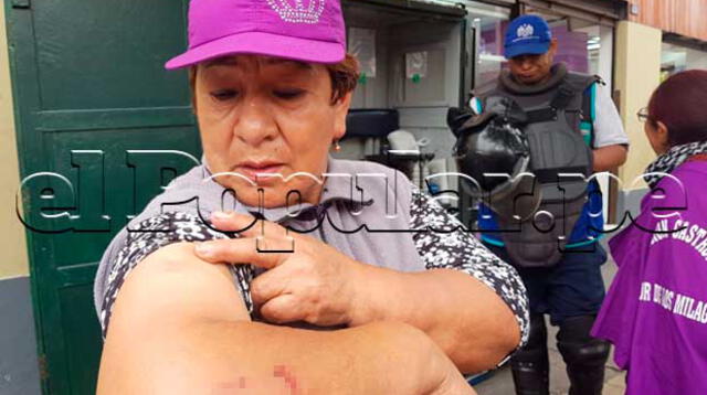 Mujeres agredidas deberán pasar por el médico legista