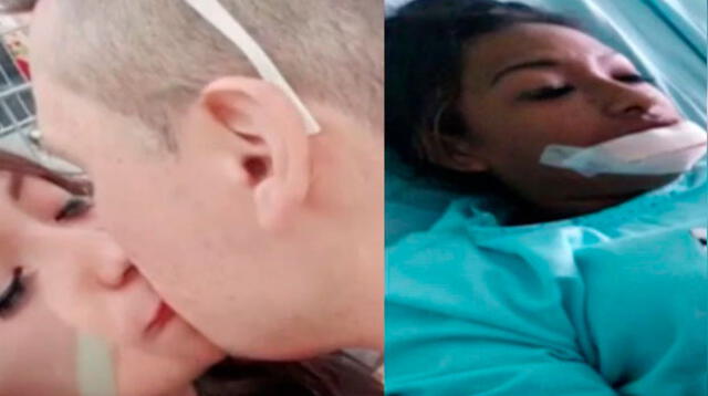 Sujeto arrancó labio de su pareja por celos