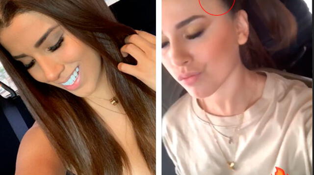 Yahaira Plasencia sufre caída de cabello y causa preocupación a sus fans