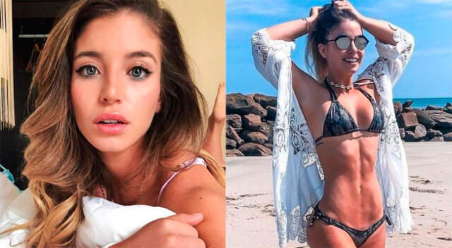 Flavia Laos muestra su rostro inflamado en Instagram.