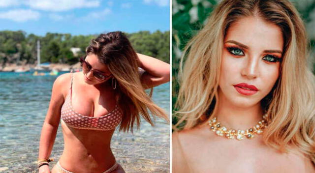 Flavia Laos muestra su rostro inflamado en Instagram.