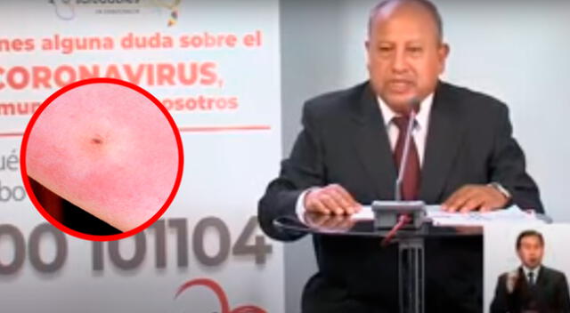 Jefe de Epidemiología del Ministerio de Salud de Bolivia Virgilio Pietro.