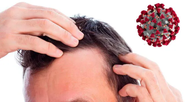 Estudio señala que pérdida del cabello es factor de riesgo ante la COVID-19.