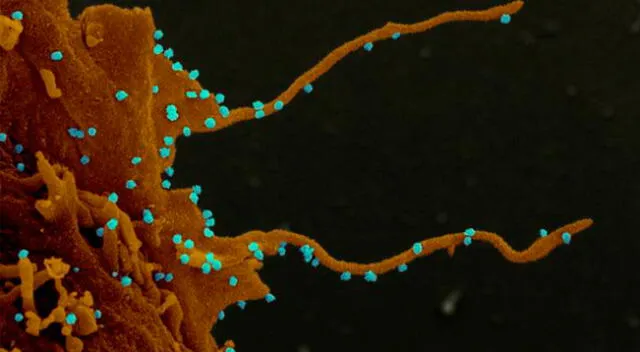 Imagen de microscopio electrónico de células renales de un mono africano infectado con Sars-Cov-2, y los tubos que usa para infectar otras células.