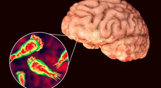 Confirman un caso de infección de la ameba “come cerebros”
