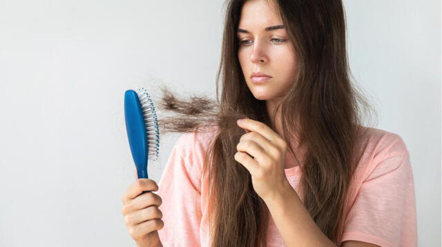 Por lo general, la calvicie alude a la caída del cabello excesiva del cuero cabelludo.