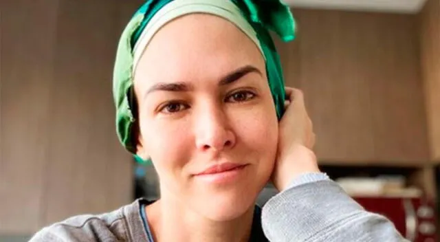 Anahí de Cárdenas tras terminar quimioterapia se reinventa y dicta talleres virtuales
