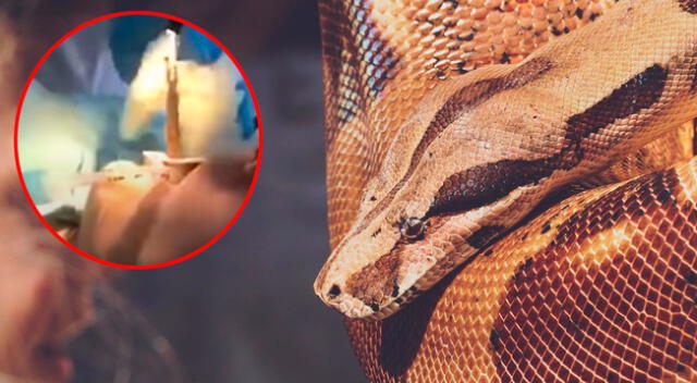 Extraen una serpiente de la garganta de una mujer