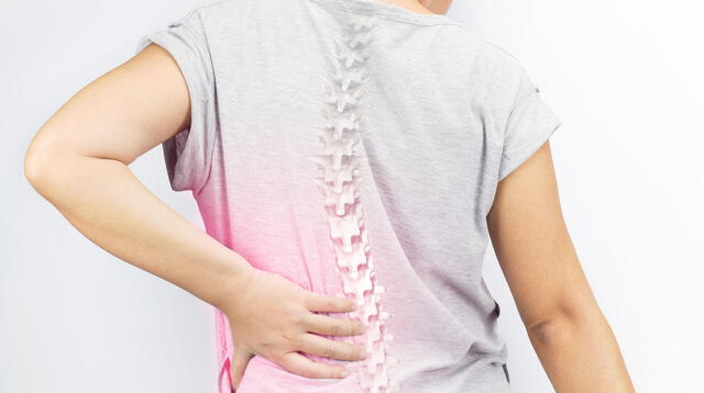 La escoliosis es una curvatura lateral de la columna vertebral que ocurre con mayor frecuencia durante el período de crecimiento anterior a la pubertad.