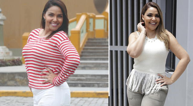 Vernis Hernández se hará cirugía bariátrica tras subir 20 kilos