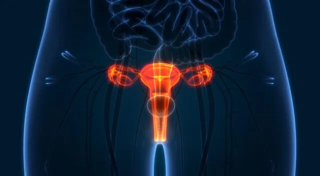 El cáncer de cuello uterino es la principal causa de muerte en las peruanas.