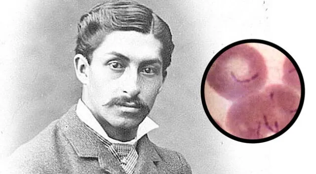 El verdadero rostro de Daniel Alcides Carrión la bacteria bartonelosis.