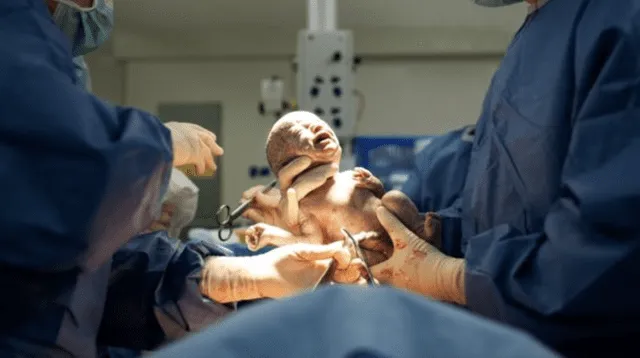 El increíble episodio tuvo lugar en un hospital ubicado en la ciudad de Dubái.