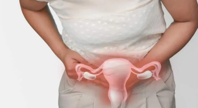 Cáncer de cuello uterino afecta a miles de peruanas