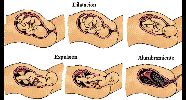 El parte tiene tres fases: dilatación, expulsión y alumbramiento.