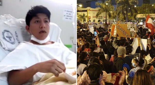 Joven universitario recibió un impacto de proyectil en la cabeza y jefe de Emergencia del Hospital Casimiro Ulloa, Luis Tenorio, señaló que la operación es imposible por la condición del proyectil.