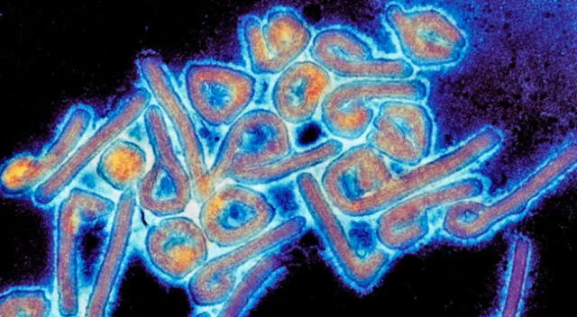 El Chapare puede ser confundido con el ébola, o incluso dengue.