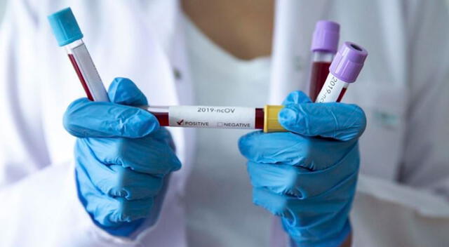 Turquía anuncia que tendrán vacuna contra el COVID-19 en el mes de abril