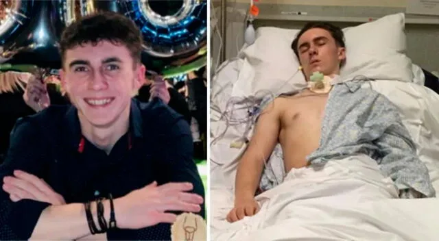 Joseph Flavill, de 19 años, sufrió un atropello en marzo de 2020.