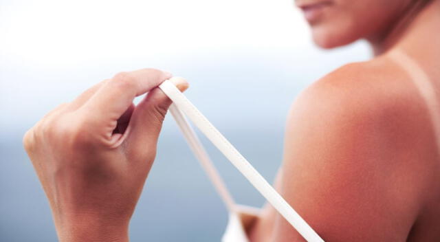 La insolación daña la piel y con el tiempo podría ser un factor para el cáncer.