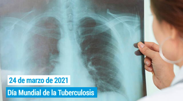 La tuberculosis es causada por una bacteria llamada Mycobacterium tuberculosis atacan a los pulmones, pero también puede afectar a otras partes del cuerpo.