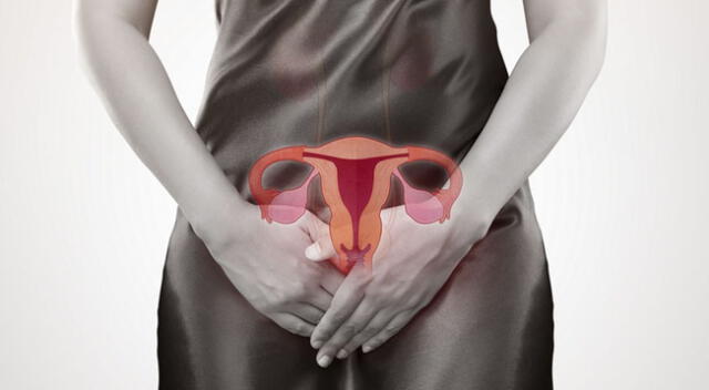 7 factores que aumentan riesgo de desarrollar cáncer de cuello uterino