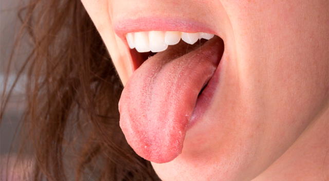 El color o su textura de la lengua pueden revelar datos muy interesantes del organismo.