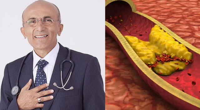 José Luis Pérez Albela recomienda bajar el colesterol.