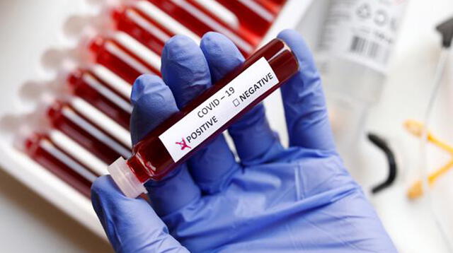 Los biomarcadores sanguíneos están surgiendo como herramientas importantes en trastornos.