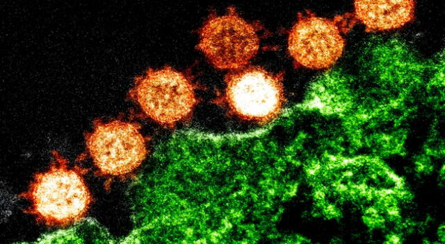 En imágenes, el virus del SARS-Cov-2 infectando a las células humanas.