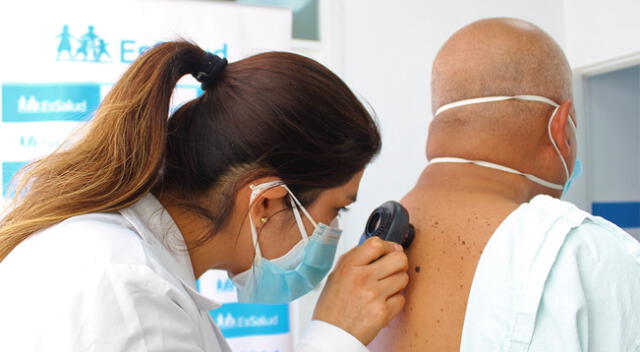 El cáncer de piel ocupa el tercer puesto en el país.