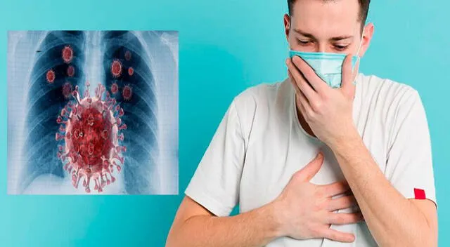 El covid-19 y la tuberculosis afectan gravemente el sistema respiratorio.
