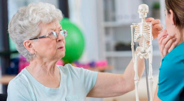 La osteoporosis hace que los huesos se debiliten y se vuelvan quebradizo.