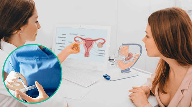 La prueba del Papanicolaou puede detectar cáncer y otras enfermedades venéreas.